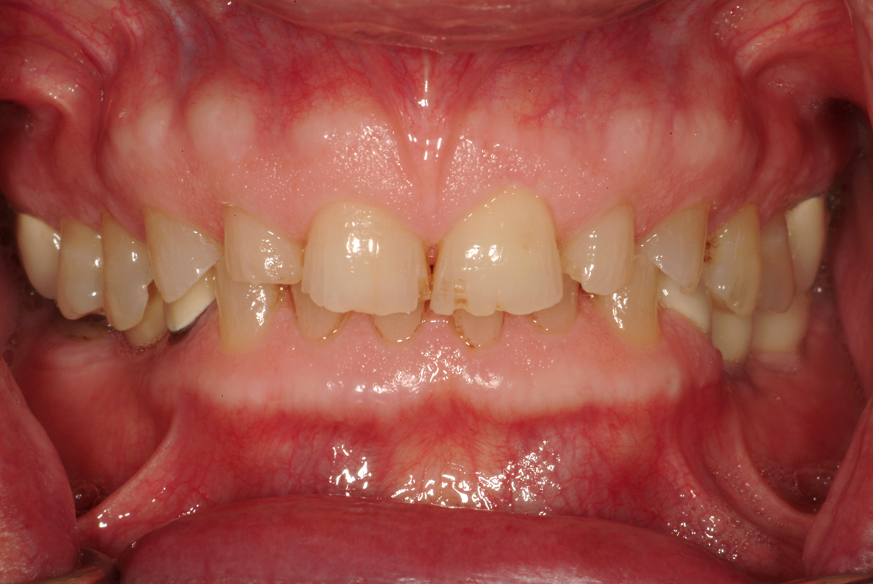 Dental News Occlusion principles for the practising dentist in the